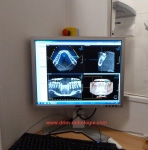 Gramercy Smiles | Root Canals, Dental Fillings and Periodontal Treatment