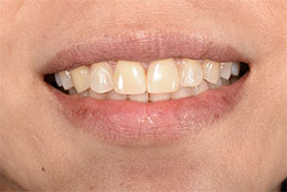 Gramercy Smiles | Dental Cleanings, Pediatric Dentistry and Periodontal Treatment