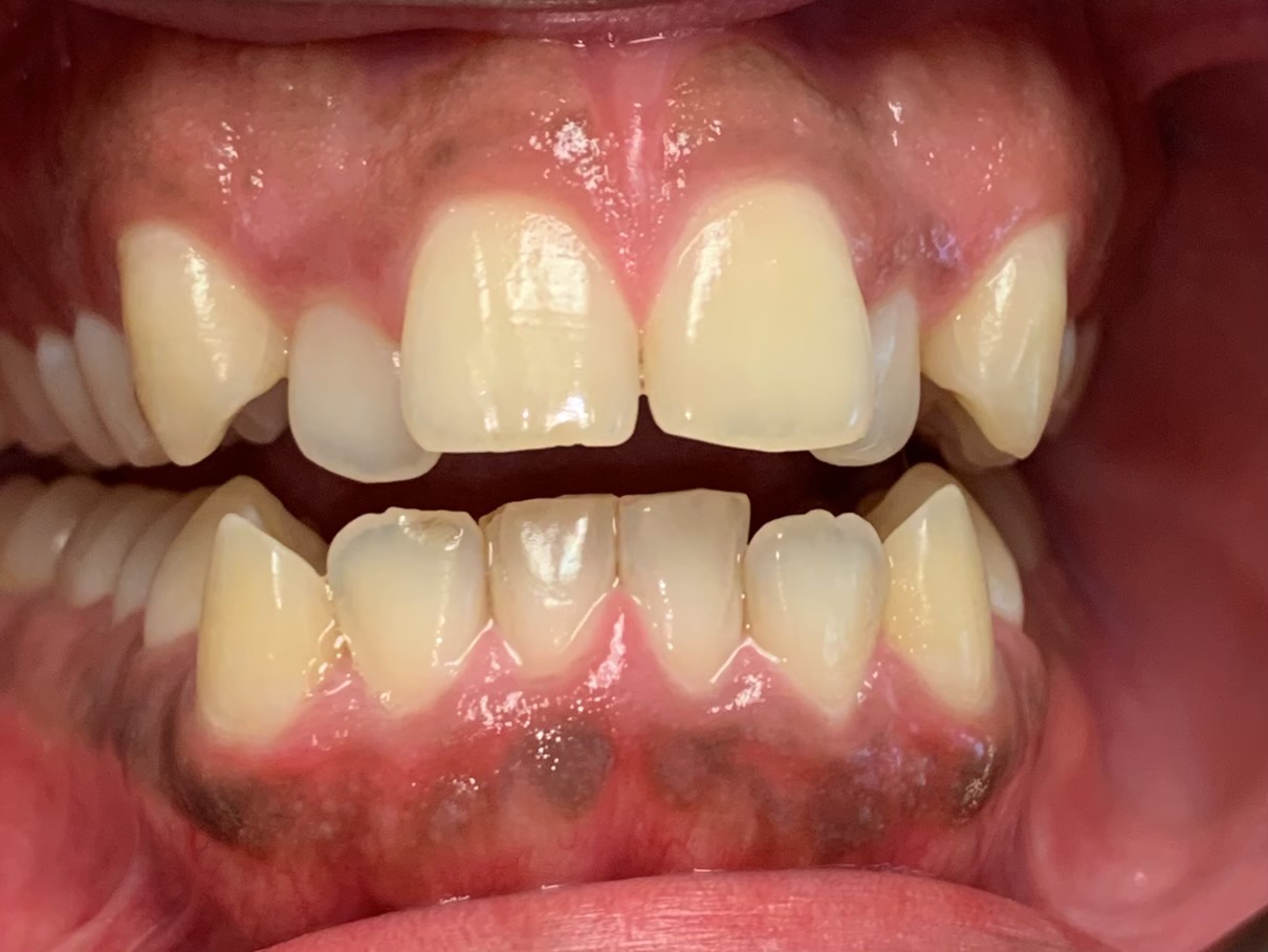 Gramercy Smiles | Zeiss reg  Microscope, Cosmetic Dentistry and Digital Radiography