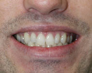 Gramercy Smiles | CBCT, Zeiss® Microscope and Cosmetic Dentistry