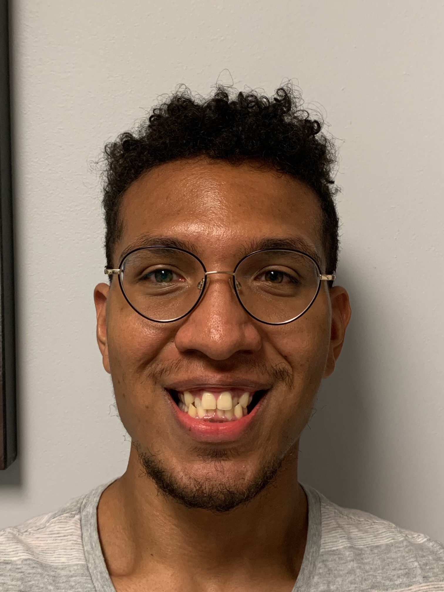 Gramercy Smiles | Periodontal Treatment, Zeiss® Microscope and Crowns & Caps