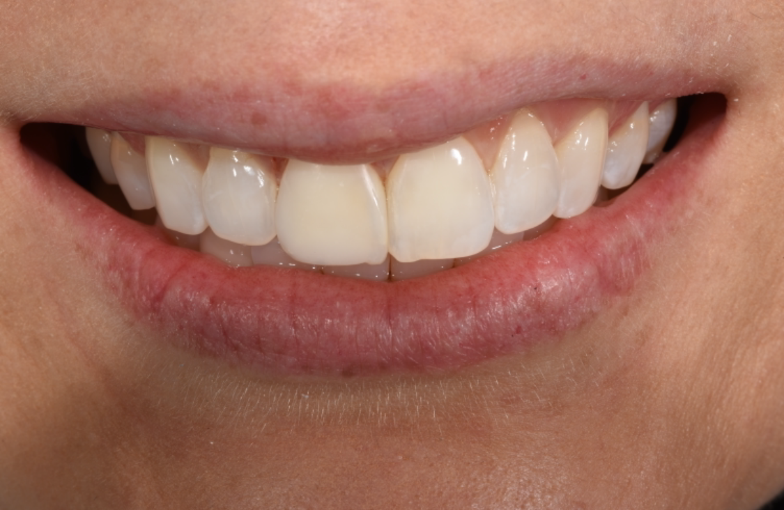 Gramercy Smiles | Periodontal Treatment, Zeiss® Microscope and Digital Radiography