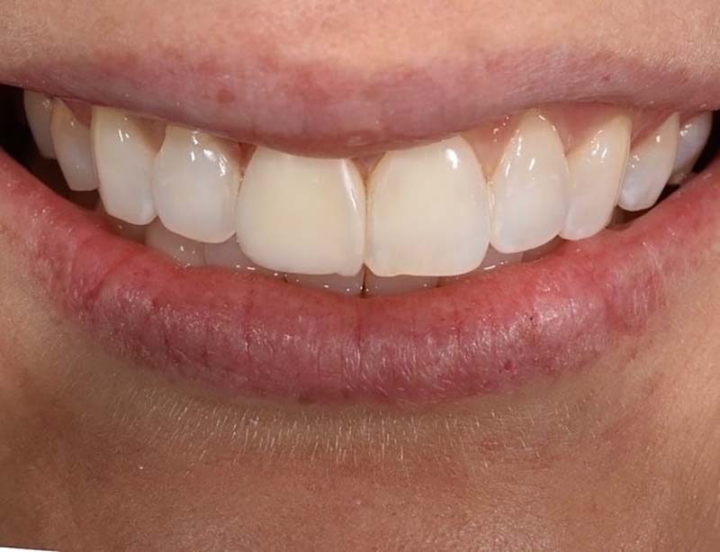 Gramercy Smiles | CBCT, Extractions and Laser Dentistry