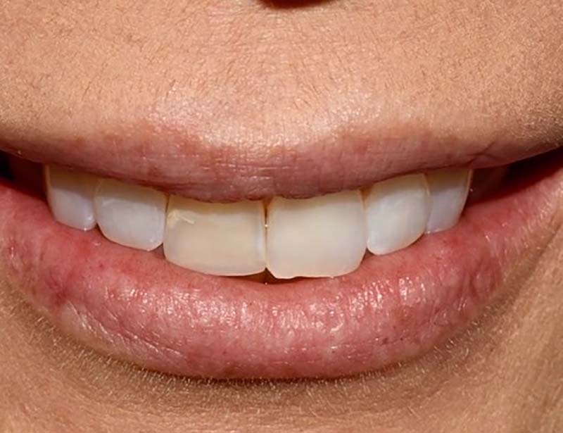 Gramercy Smiles | Preventative Program, Oral Surgery and Dental Cleanings