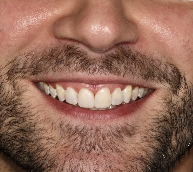 Gramercy Smiles | Periodontal Treatment, Cosmetic Dentistry and Implant Restorations