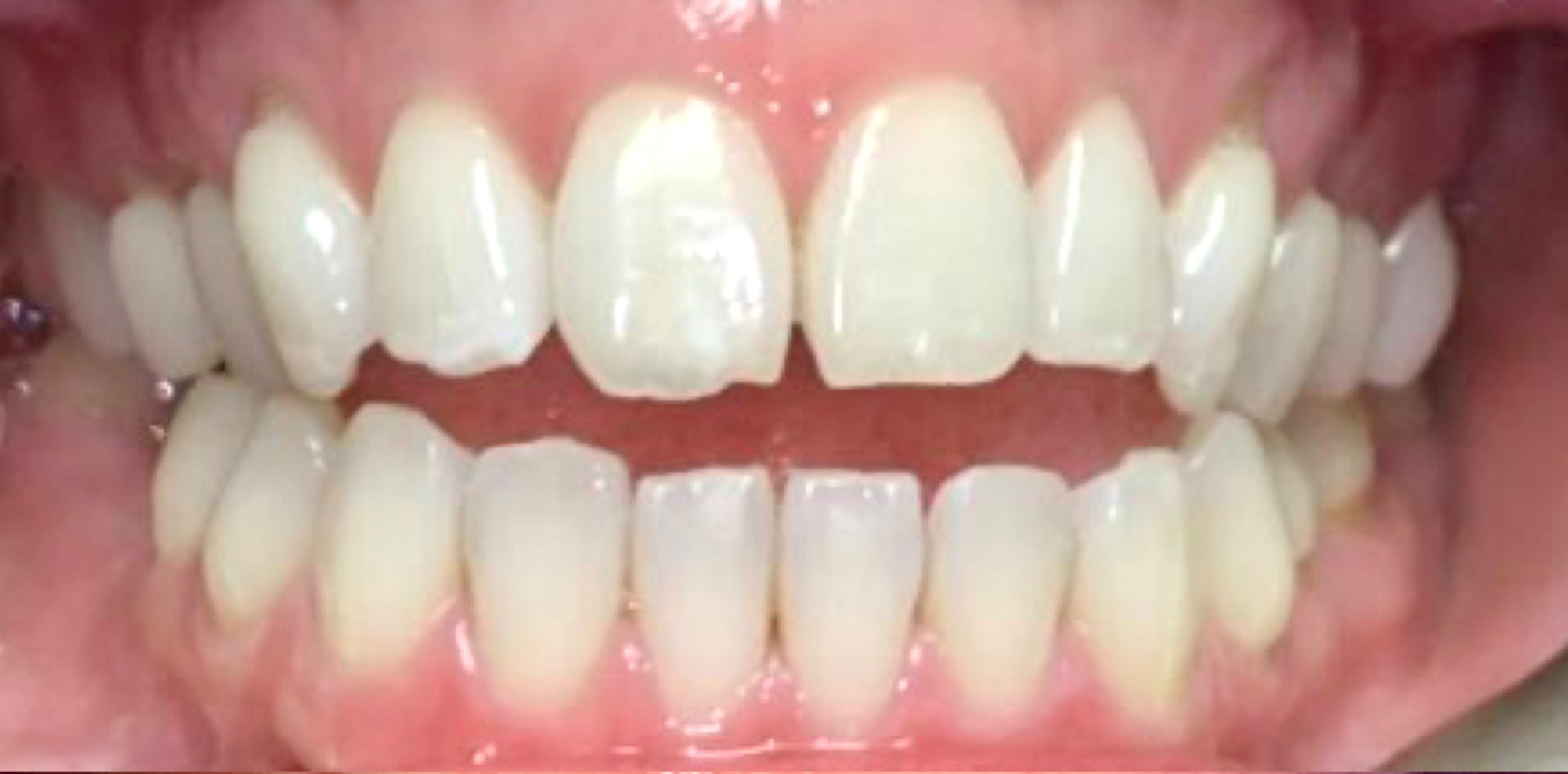 Gramercy Smiles | Digital Radiography, Extractions and CBCT