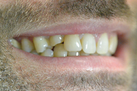 Gramercy Smiles | Dental Fillings, Digital Radiography and Periodontal Treatment