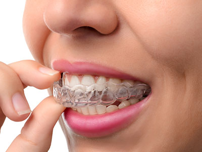 Gramercy Smiles | Veneers, Oral Surgery and Sleep Apnea